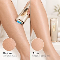 Ice‑Cool IPL Hair Removal Device, Painless Laser Hair Remover for Face, Body, Bikini Area, At‑Home Permanent Hair Removal Machine
