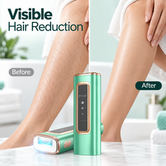 Ice-Cool IPL Hair Removal Device, 5 Adjustable Energy Levels, Manual & Automatic Modes, Painless At-Home Full-Body Hair Remover